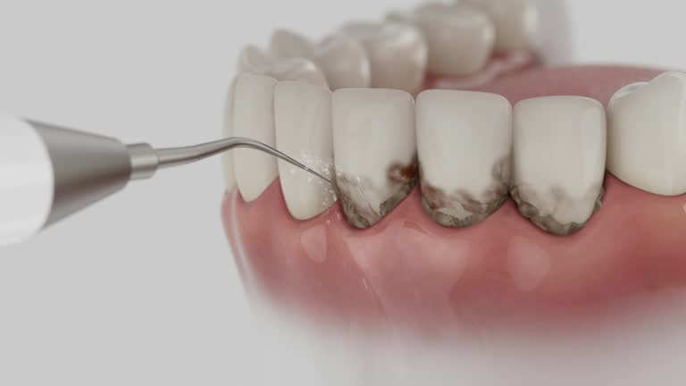 Reliable Dental contractor in Bridgeton, MO by Dentist Open Now
